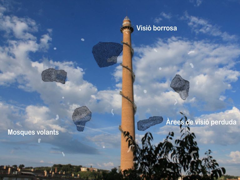 Imagen ejemplo de paciente con Retinopatía diabtética Torre alta sobre un cielo azul con zonas oscuras, filamentos blancos, zonas borrosas que simulan la visión de una retinopatía diabética.