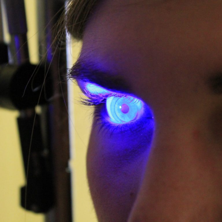 Contactología especializada Ojo con una lentilla iluminado con luz azul cobalto de la lámpara de hendidura.